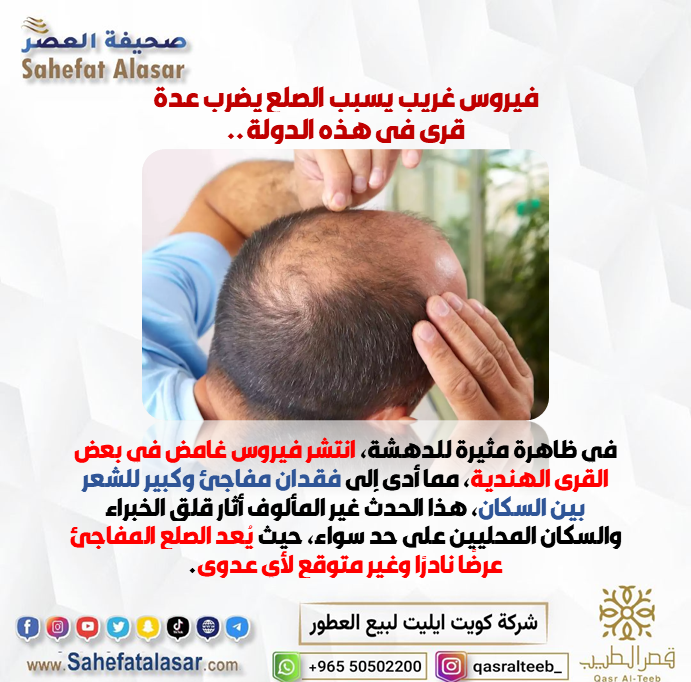 فيروس غريب يسبب الصلع يضرب عدة قرى في هذه الدولة..